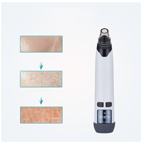 PoreClear™ Blackhead Remover Vacuum